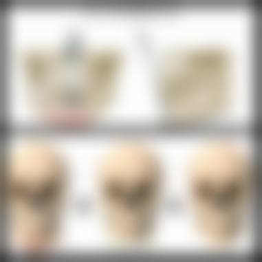 朴秀镐医生技术或实力