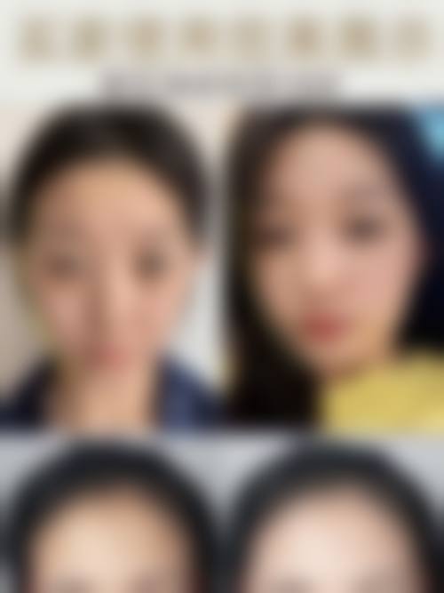 湖北十堰慕她整形医生团队经验稳定