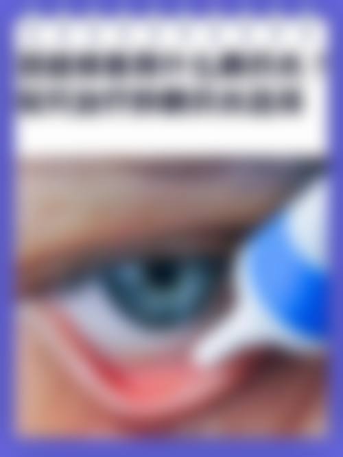 预约优惠活动