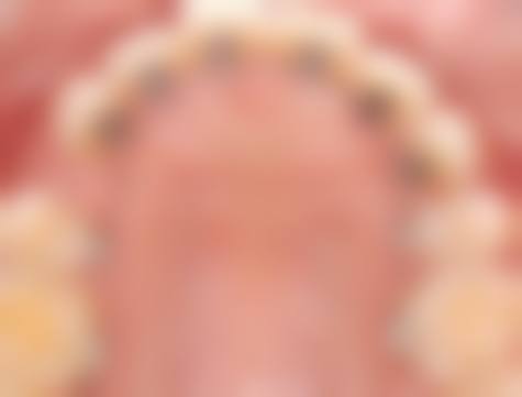 常见问题解答