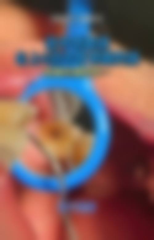 鹤壁博恩口腔门诊部擅长项目。