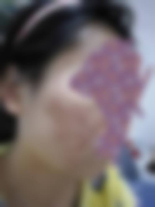 东莞华美医疗美容医院治疗反馈与口碑评价。