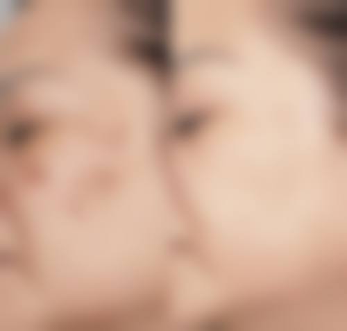 襄阳德尔美客西子医疗整形美容门诊部治疗反馈与口碑评价。