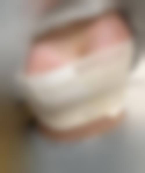 深圳富华医院唐新辉怎么样？20 余年经验，金字塔隆鼻 2.0 技术超厉害！ 