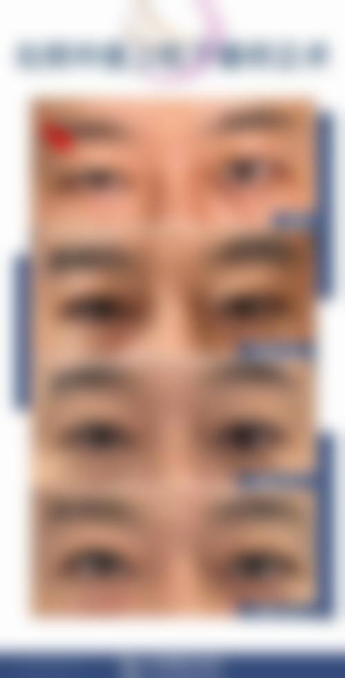 预约优惠活动