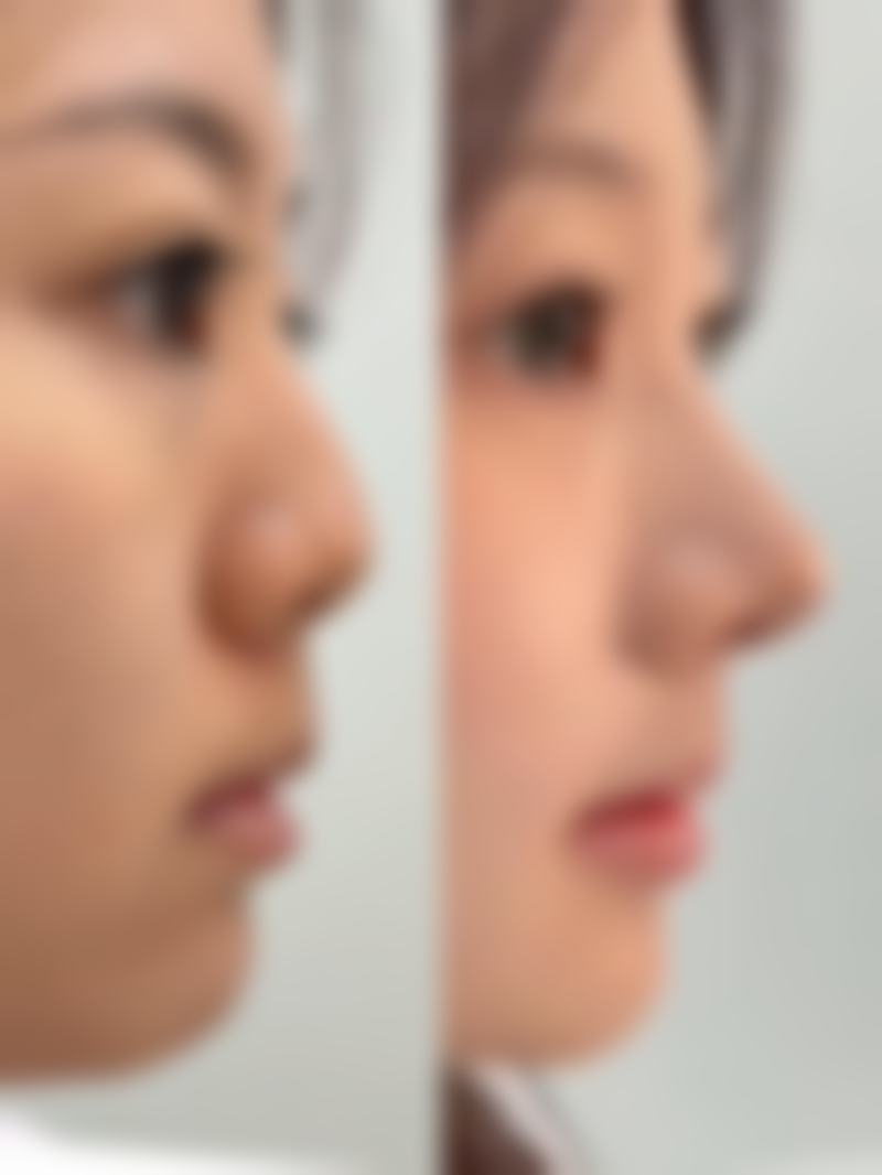 收费合理透明