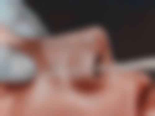 三、雷中元医生的自体软骨隆鼻术后成效有多自然?