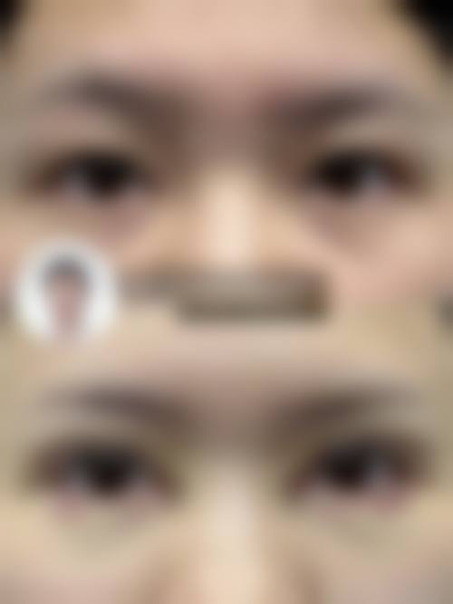 眼睛双眼皮一个大一个小的化妆调整