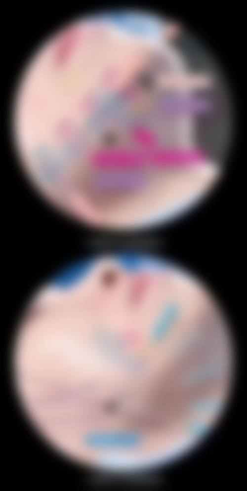 临床实例分享