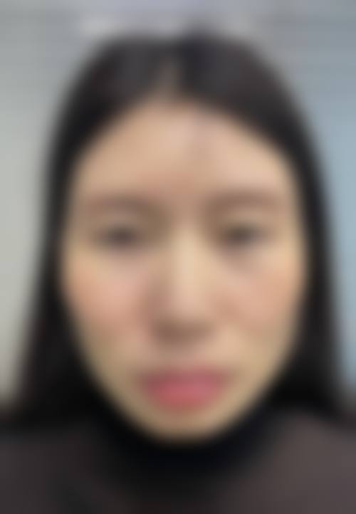 济南蓝白整形医院擅长项目。