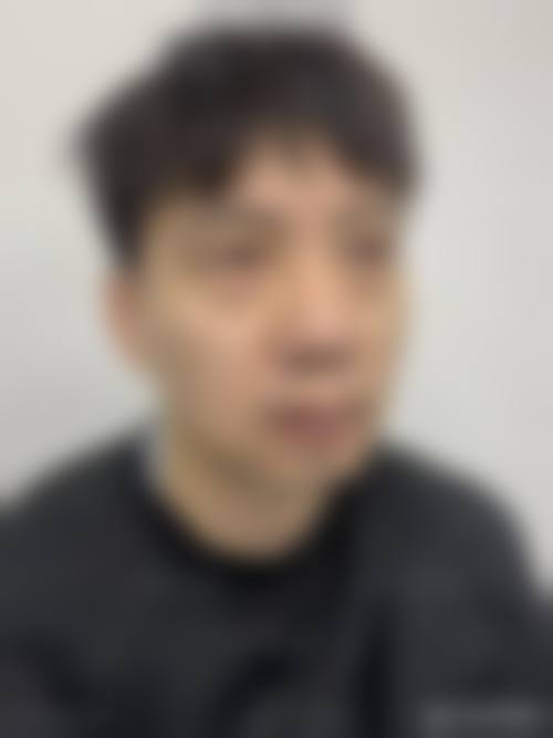龙岩爱丽诺整形美容门诊部治疗反馈与口碑评价。