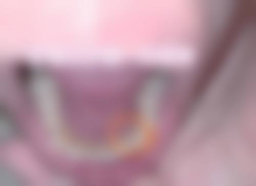 擅长项目详解