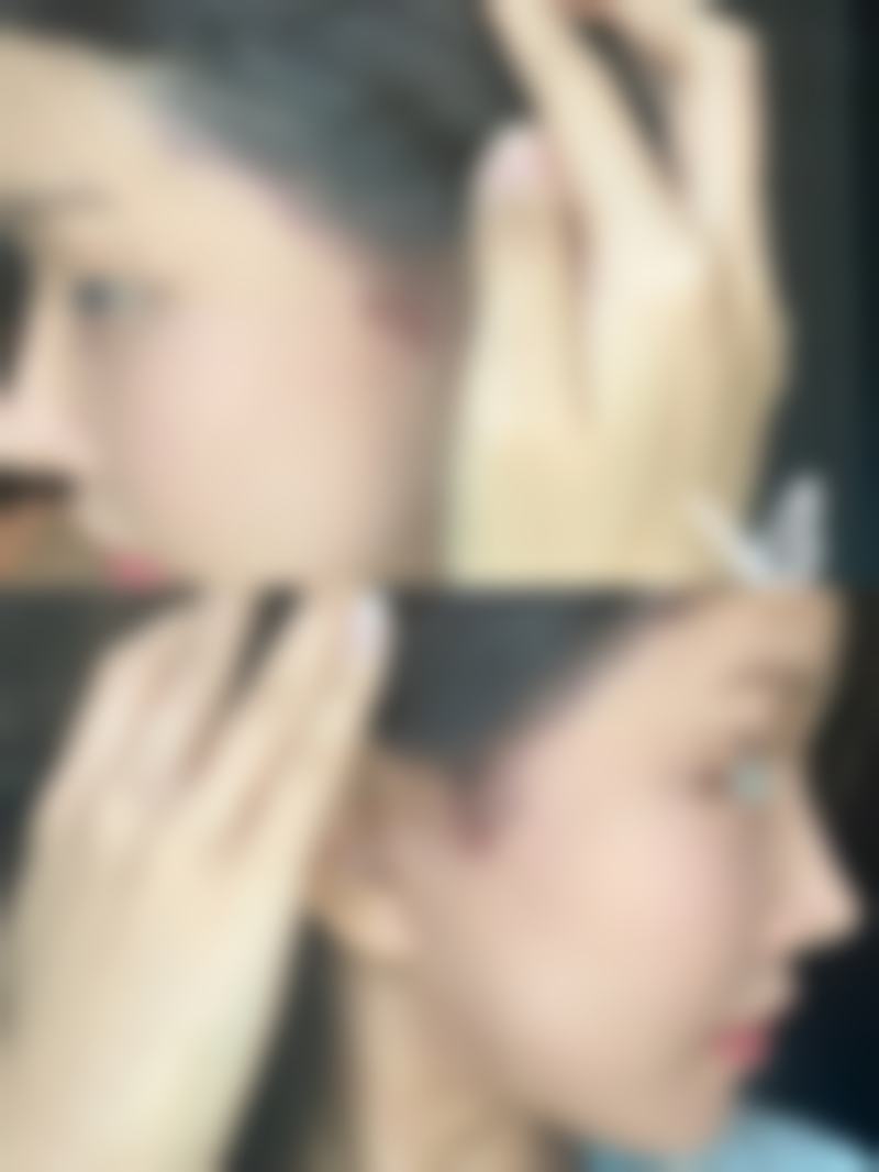 五、张立天医生和成都东篱医院的患者口碑如何