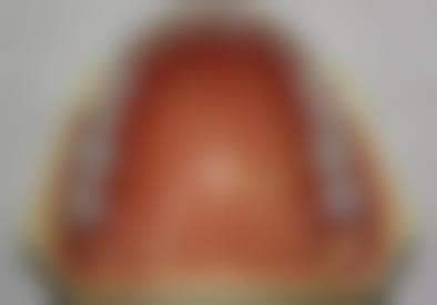 优惠活动详情:多重补贴助力口腔健康