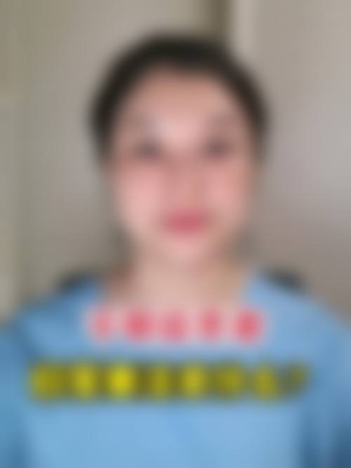 天津医 科 大学眼科医院整形美容科2026年价格收费表: