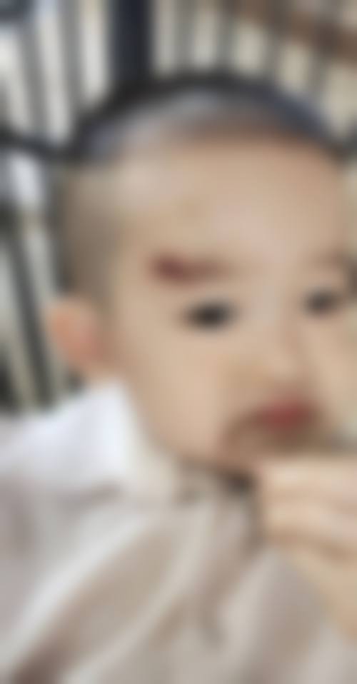 天津医 科 大学眼科医院整形美容科治疗反馈与口碑评价。