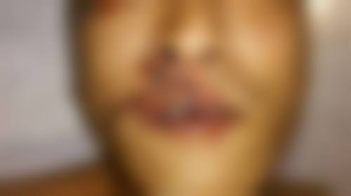 惠州市伊美医疗美容地理位置便于到院。