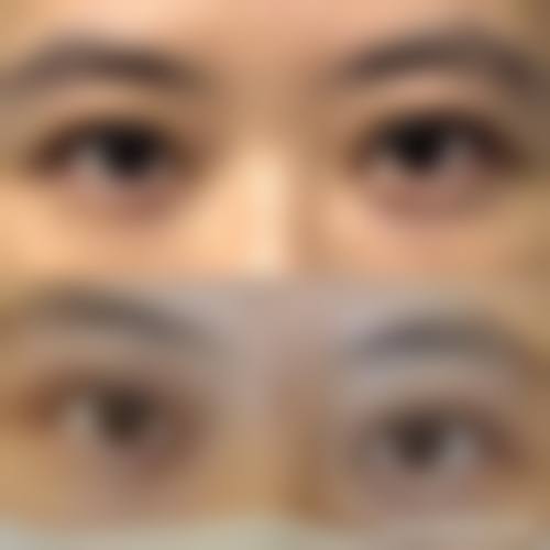 2026石家庄玻尿酸填充优质机构
