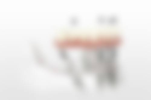 刘虔医生擅长项目