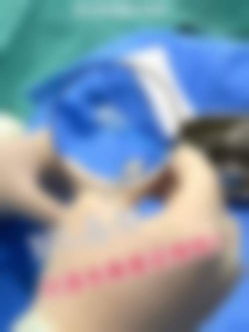 河源东江眼科
