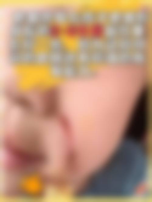 北京医生:增生疤痕修复经验分享