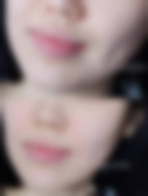广州因你美妍整形医院擅长项目。