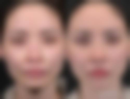 武汉爱美快线整形医院擅长项目。