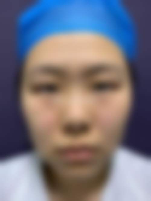 闫咏梅医生擅长项目