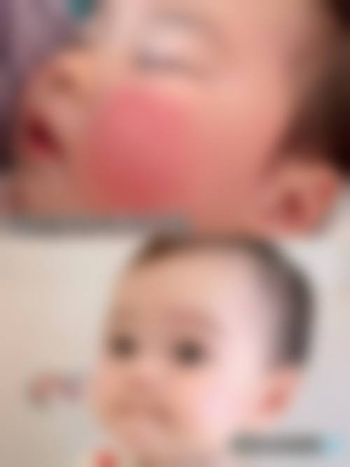 河北医 科 大学第三医院眼科预约挂号方式。