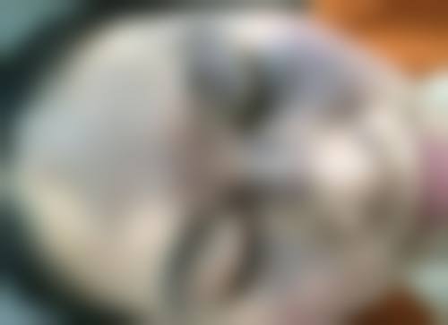 皮肤护理项目：焕发光彩的肌肤秘诀
