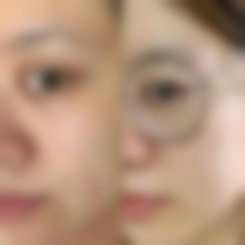 西安卢丙仑奥斯卡整形美容门诊部医生团队经验稳定。