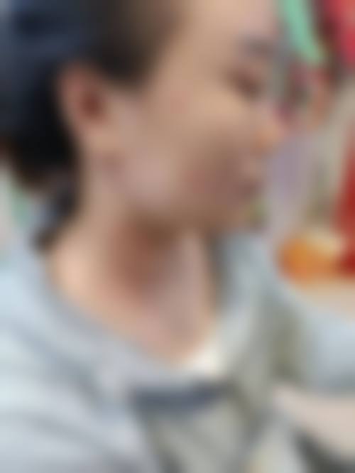 西安卢丙仑奥斯卡整形美容门诊部治疗反馈与口碑评价。
