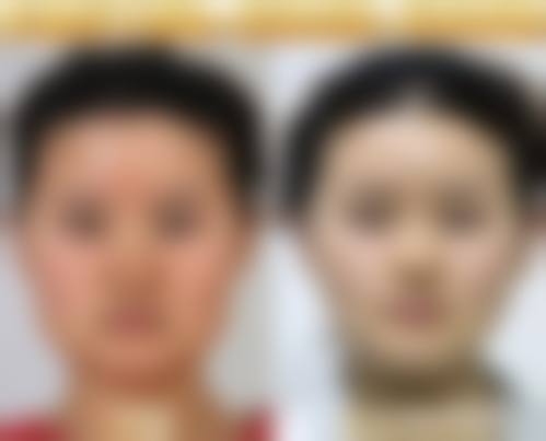 重庆沙坪坝柳叶刀医疗美容门诊部预约挂号方式。