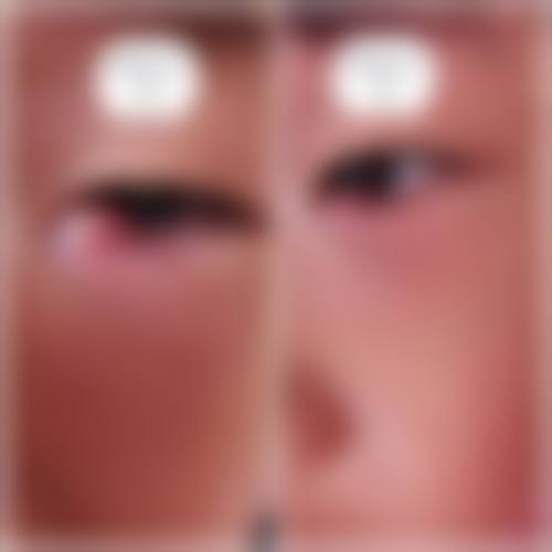 临床实例分享