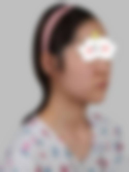 胸部修复与其他项目反馈
