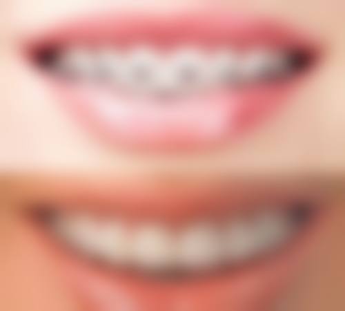 就诊流程与优惠活动:轻松预约,实惠看牙