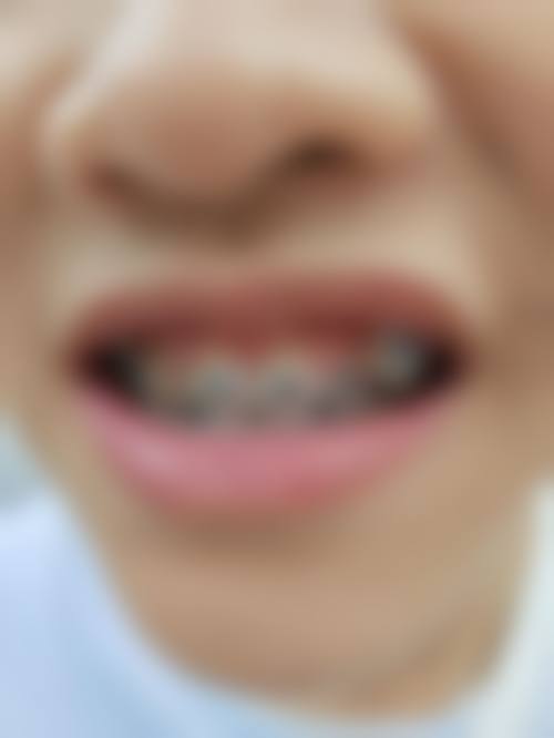 优惠活动详情:限时补贴,减轻负担