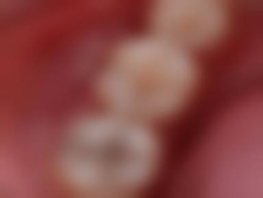 新医 大一附院口腔科预约挂号方式。