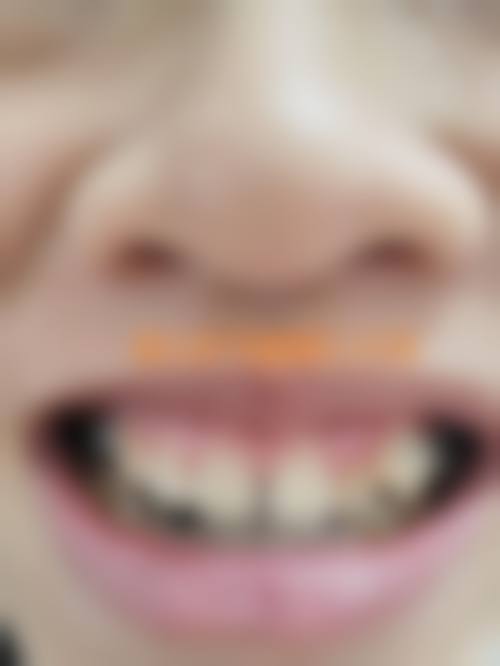 擅长项目详解