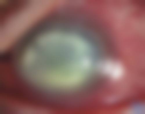 周口市妇幼保健院眼科地理位置便于到院。