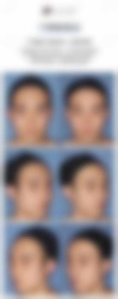 徐州矿务总医院整形美容中 心设备优势