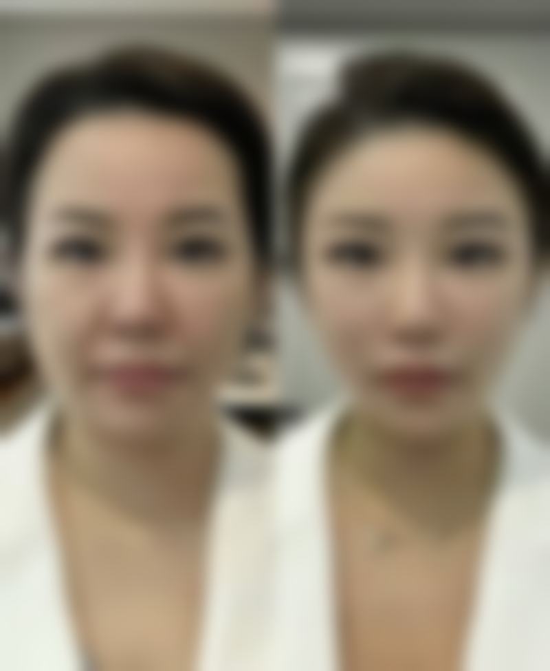 河南省人民医院(医学美容)：公立保障安全变美，多领域专家及先进技术助力一站式医美！ 