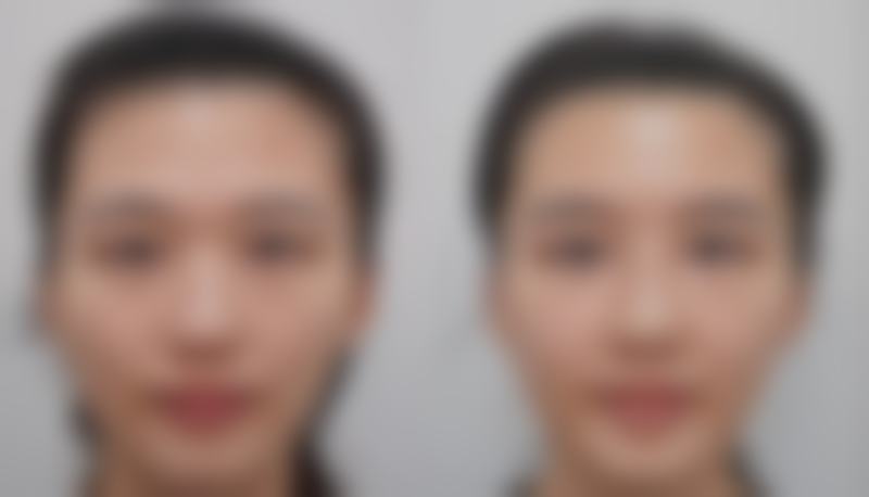 李显忠医生技术实力体现