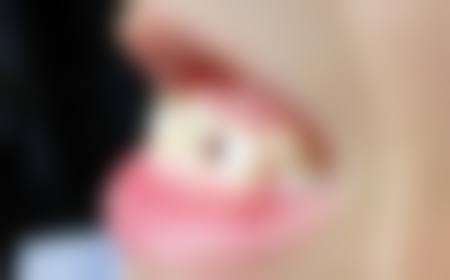 关于贾双琴医生的快问快答