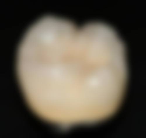 菏泽开发区杜丽口腔擅长项目。