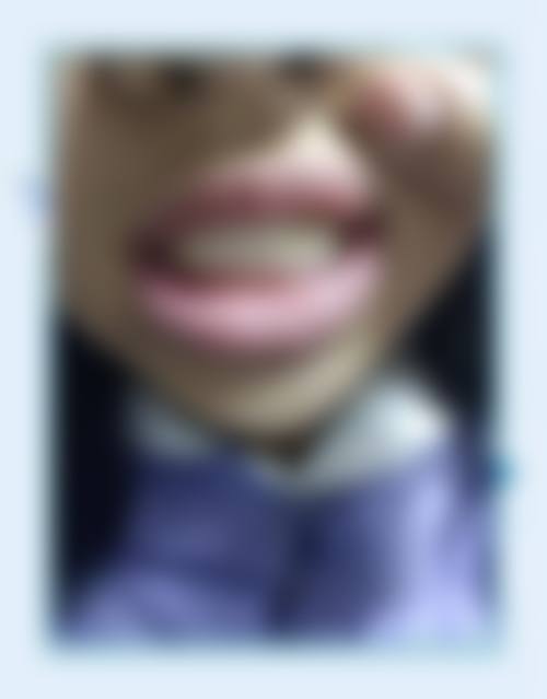 临床实例分享