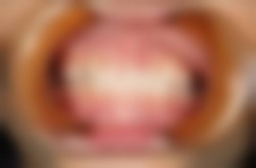 泰康拜博口腔高新门诊部治疗反馈与口碑评价。