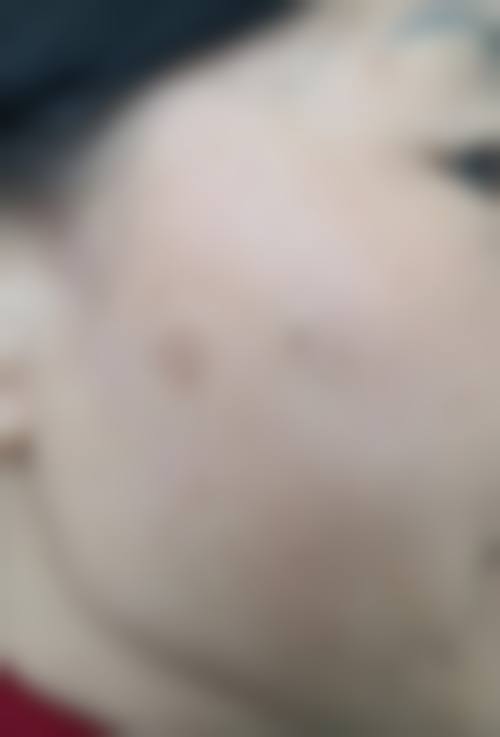 倪育民医生擅长项目