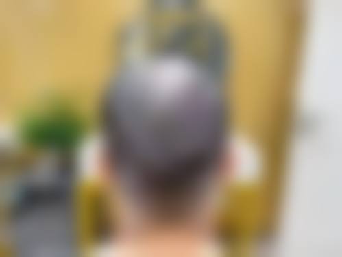上海吴月兰整形美容诊所治疗反馈与口碑评价。