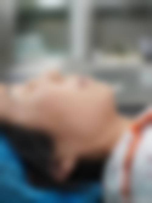 王上上医生技术实力展现